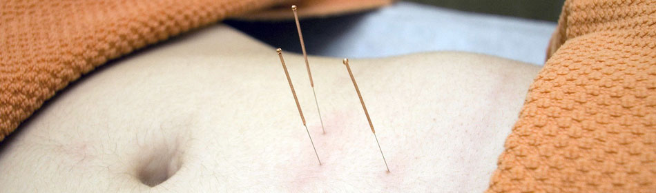 Accupuncture, Eastern Healing Arts in the Yardley, Bucks County PA area